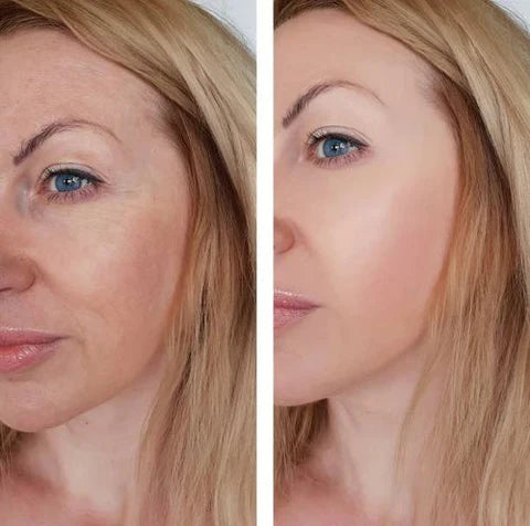 Rejuvenating Face Lift Cream