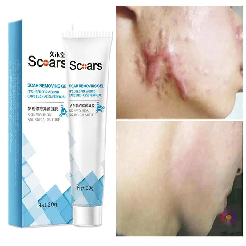 SCARS - Herbal Scar Repair Cream