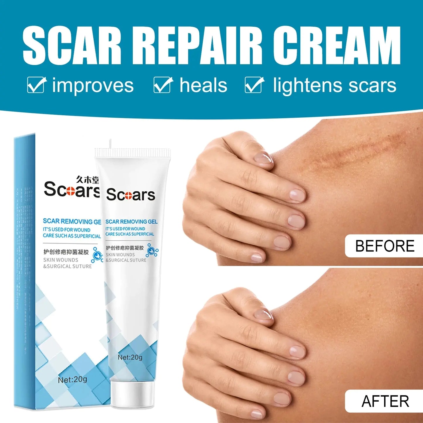 SCARS - Herbal Scar Repair Cream