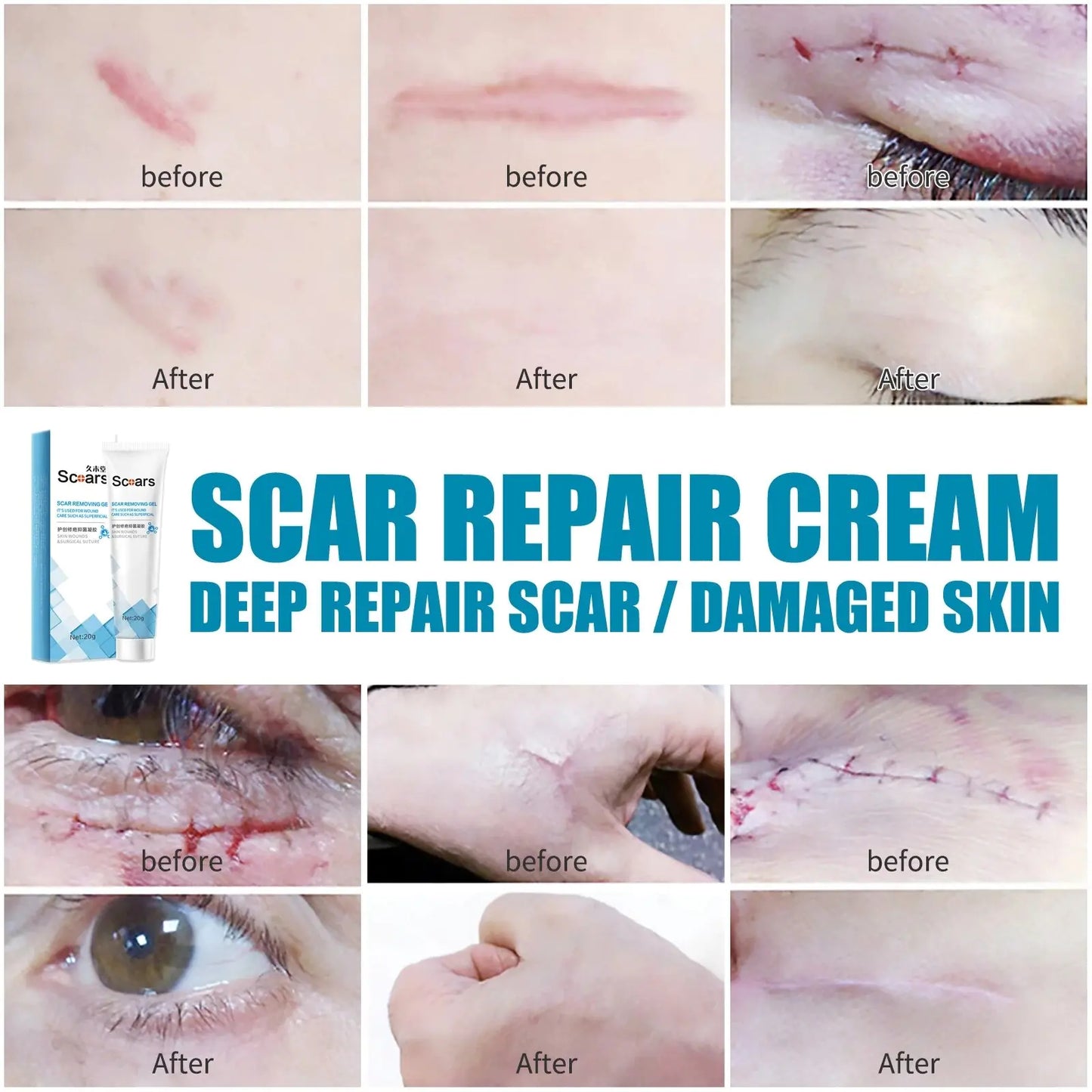 SCARS - Herbal Scar Repair Cream