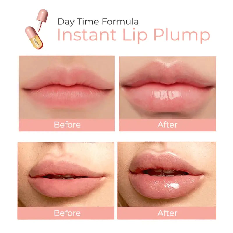 Lip Plumper Kit 