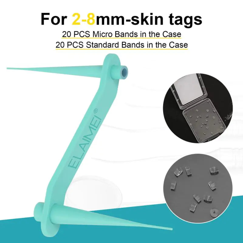  Automatic Skin Tag Remover Kit