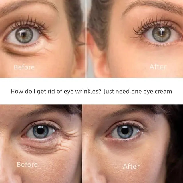 Anti-wrinkle Eye Cream